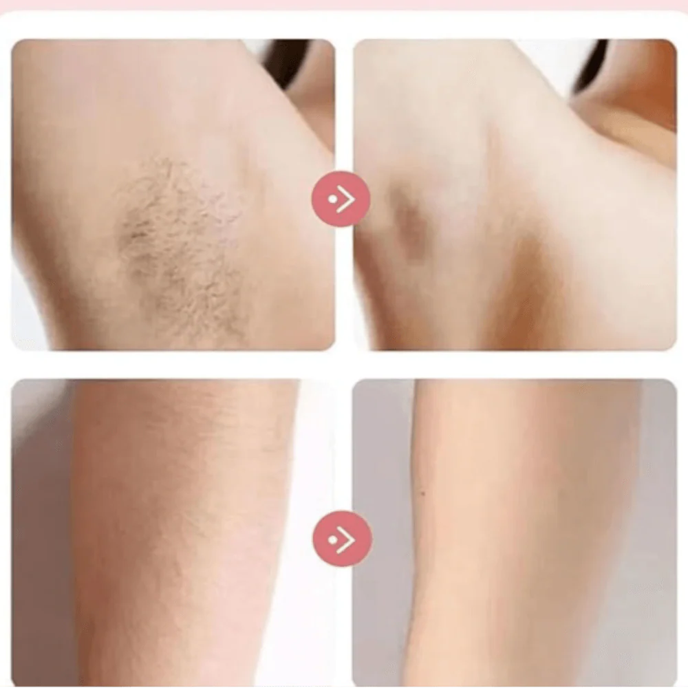 SilkyTrim | Nano scheerapparaat - Image 6